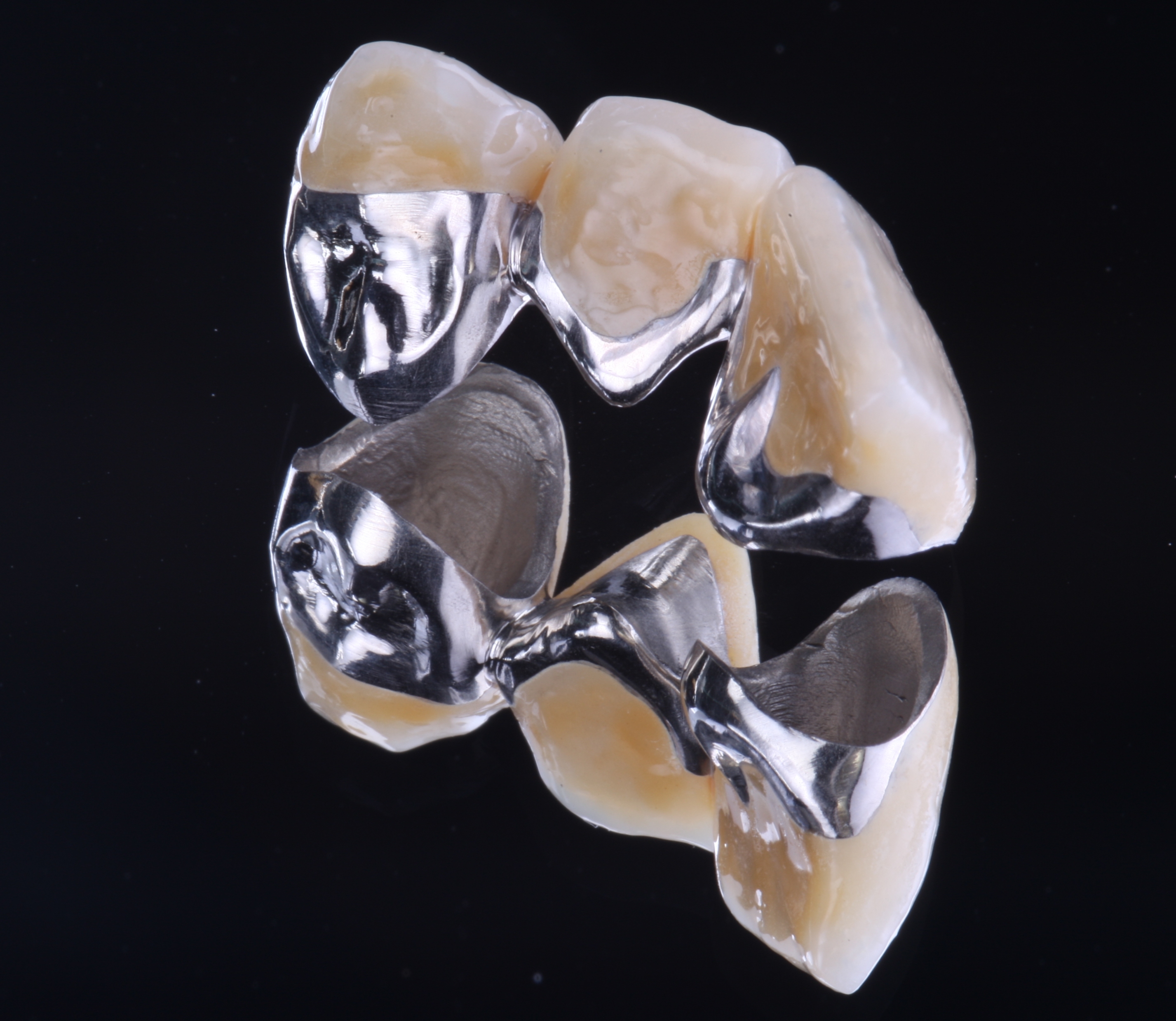 Die Zähne des Zahnersatz bestehen aus Keramik und werden durch Metall zusammen gehalten