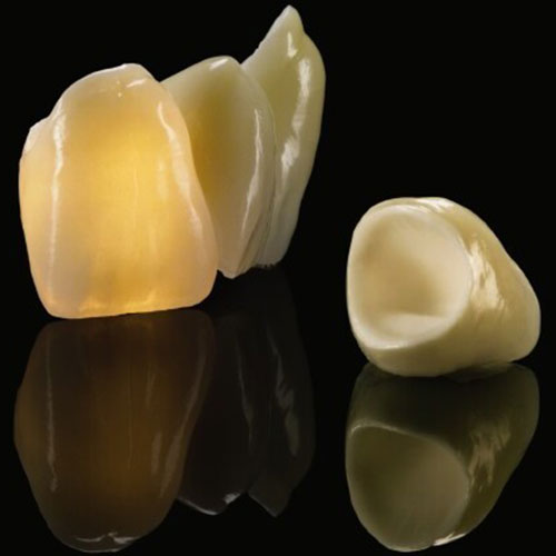 Zahnimplantate ohne Metall